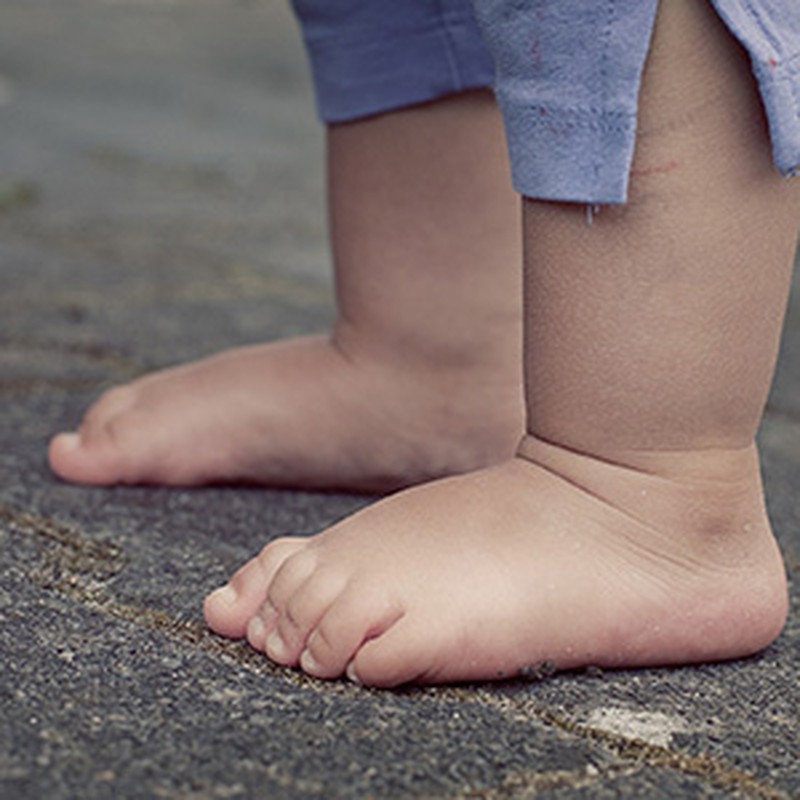 Cuidado de los pies en niños