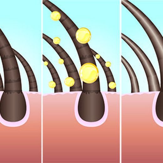 Consejos para un cabello sin caspa