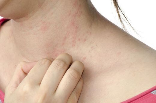 ¿Sabes cómo tratar las pieles atópicas?