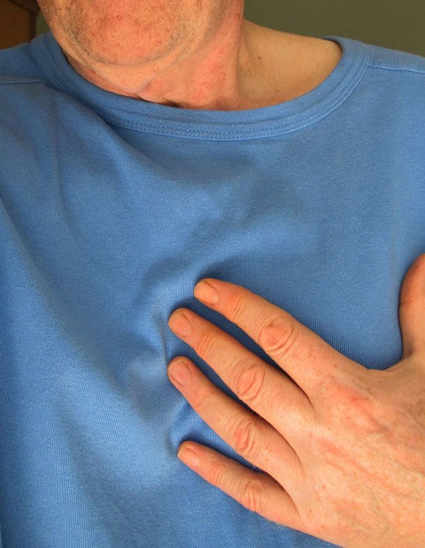 Cómo cuidarte después de sufrir un infarto