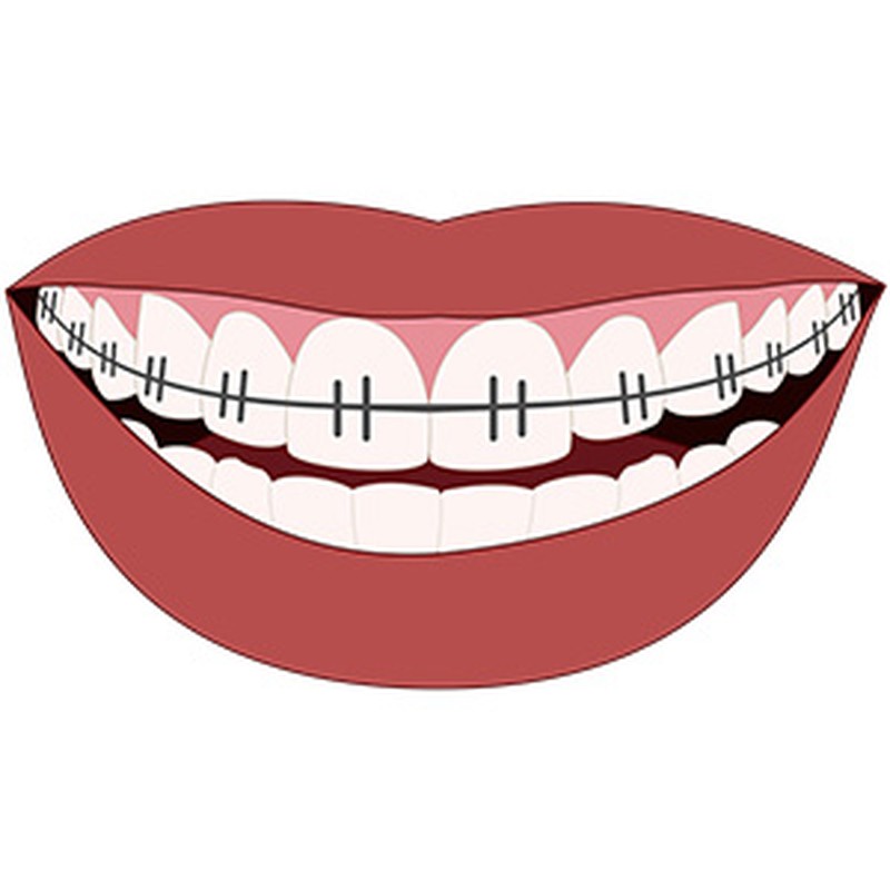 Cómo cuidar nuestra boca con ortodoncia