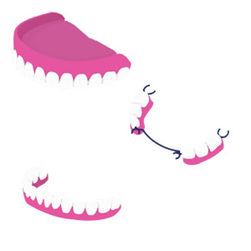 Cómo aplicar el adhesivo para prótesis dentales