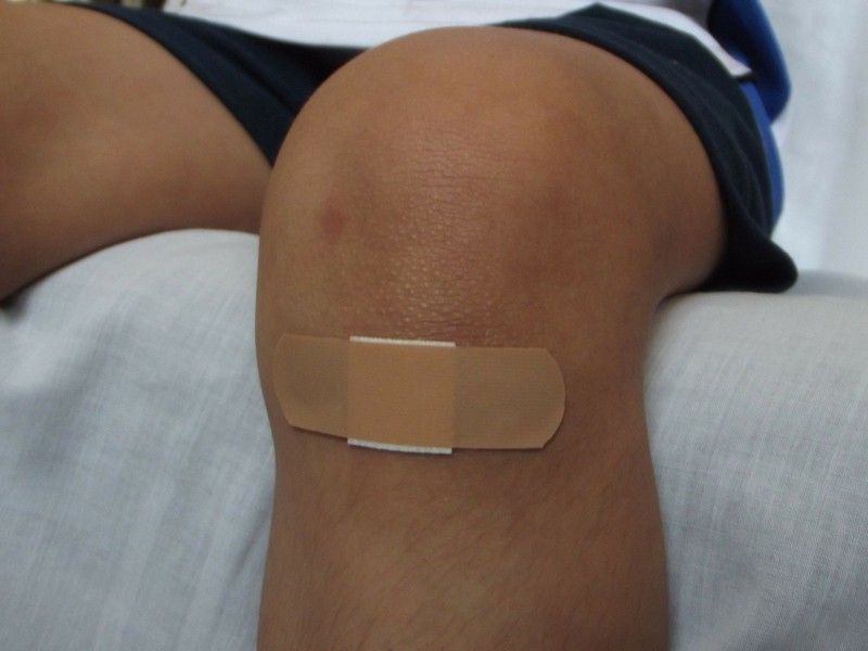 Qué hacer en caso de golpes y caídas